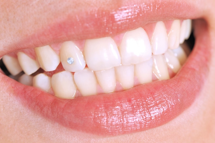 piercing dental