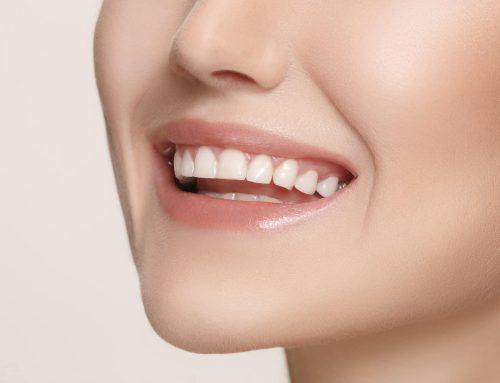 Carillas dentales: el «secreto» de los famosos para lucir una sonrisa perfecta