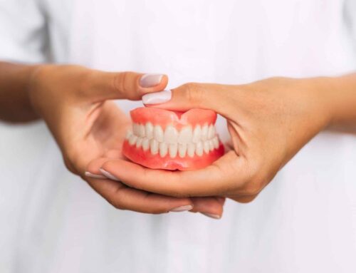 Estética gingival: todo lo que debes saber